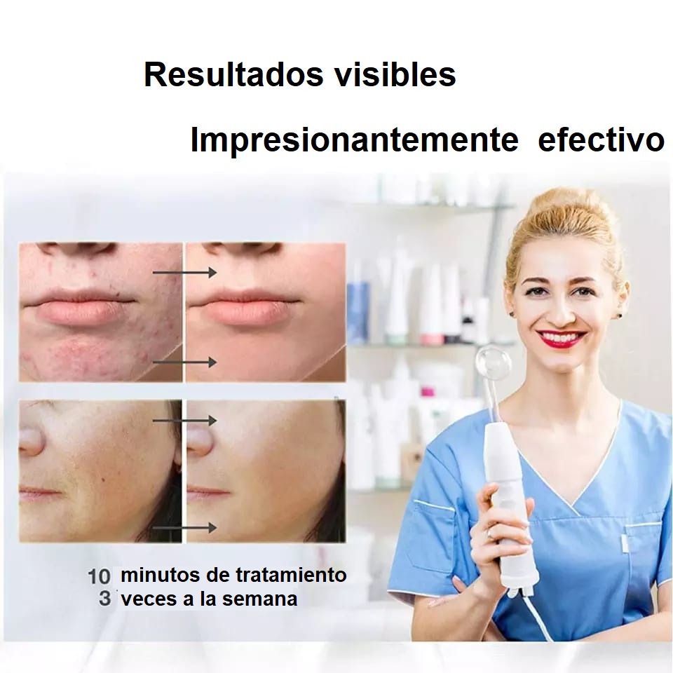 DISPOSITIVO DE ALTA FRECUENCIA FACIAL - Imagen 8
